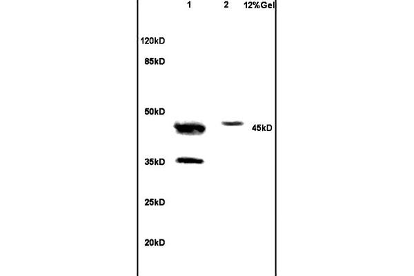 anti-Neutrophil Cytosol Factor 1 (NCF1) (AA 151-250) antibody