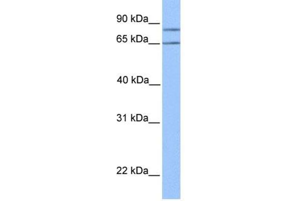OXCT2 antibody  (Middle Region)