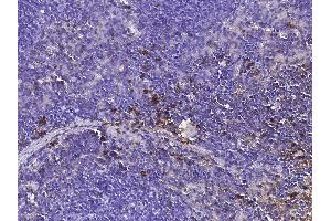 Image no. 1 for anti-Hepatocyte Growth Factor (Hepapoietin A, Scatter Factor) (HGF) (AA 1-728) antibody (ABIN2692294)