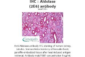 Image no. 1 for anti-Aldolase (ALD) antibody (ABIN1723927)
