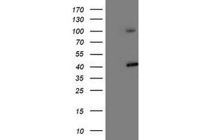 Image no. 4 for anti-Proteasome (Prosome, Macropain) 26S Subunit, Non-ATPase, 2 (PSMD2) antibody (ABIN1500479)