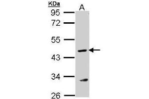 Image no. 2 for anti-Argininosuccinate Lyase (ASL) (Center) antibody (ABIN2856702)
