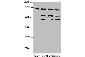 Image no. 1 for anti-Zinc Finger, FYVE Domain Containing 1 (ZFYVE1) (AA 1-280) antibody (ABIN6098260)