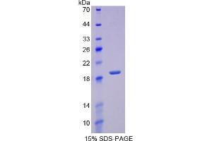 Image no. 1 for Regenerating Islet Derived Protein 3 gamma (REG3g) ELISA Kit (ABIN6720589)