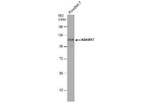 Image no. 2 for anti-ADAM Metallopeptidase Domain 17 (ADAM17) (C-Term) antibody (ABIN2855021)