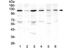 Western blot testing of human 1) HeLa, 2) HepG2, 3) SGC-7901, 4) K562, 5) rat testis and 6) mouse testis lysate with PDGFRB antibody at 0.