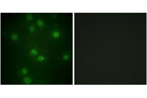 Image no. 2 for anti-Retinoblastoma Protein (Rb Protein) (AA 771-820), (pSer811) antibody (ABIN1531515)