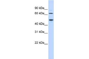 Image no. 5 for anti-Tryptophan 2,3-Dioxygenase (TDO2) (N-Term) antibody (ABIN2782334)