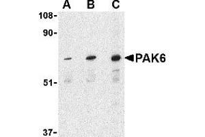 Image no. 1 for anti-P21-Activated Kinase 6 (PAK6) (Middle Region) antibody (ABIN1031032)