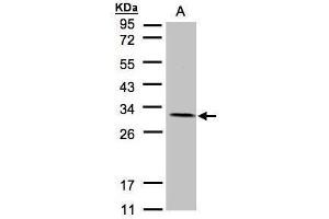 Image no. 4 for anti-NADH Dehydrogenase (Ubiquinone) Flavoprotein 2, 24kDa (NDUFV2) (Center) antibody (ABIN2855340)
