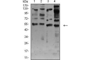 Image no. 4 for anti-Cholinergic Receptor, Nicotinic, alpha 7 (Neuronal) (CHRNA7) (AA 52-259) antibody (ABIN5611362)