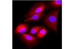 Image no. 1 for anti-N-Acetyltransferase 6 (GCN5-Related) (NAT6) (AA 1-308), (N-Term) antibody (ABIN452458)