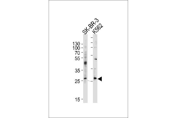 FRAT1 antibody  (C-Term)