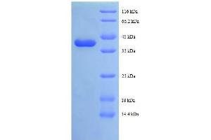 TAX1BP3 Protein (AA 1-124, full length) (GST tag)