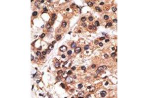 Image no. 2 for anti-Protein AF-9 (MLLT3) (C-Term) antibody (ABIN358673)