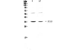 Image no. 3 for anti-Interleukin 12 alpha (IL12A) (AA 23-215) antibody (ABIN5693302)
