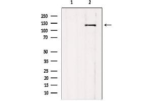 Western blot analysis of extracts from mouse brain, using CCP1 antibody.