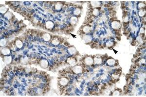 Image no. 1 for anti-TOX High Mobility Group Box Family Member 2 (TOX2) (N-Term) antibody (ABIN2779234)