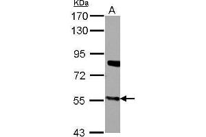 Image no. 1 for anti-Cytochrome P450, Family 27, Subfamily A, Polypeptide 1 (CYP27A1) (Center) antibody (ABIN2855688)