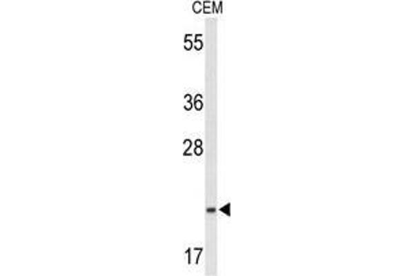 TIFA antibody  (N-Term)