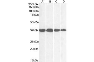 Image no. 8 for anti-Glyceraldehyde-3-Phosphate Dehydrogenase (GAPDH) (C-Term) antibody (ABIN185240)