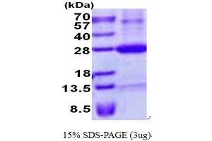 Image no. 1 for Retinoic Acid Early Transcript 1E (RAET1E) protein (His tag) (ABIN1098707)