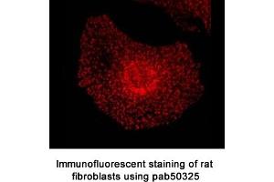 Image no. 1 for anti-Epidermal Growth Factor Receptor Pathway Substrate 15 (EPS15) (AA 840-896), (C-Term) antibody (ABIN2852261)