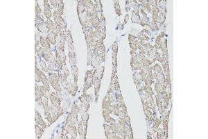 Image no. 5 for anti-CD59 (CD59) antibody (ABIN3022399)