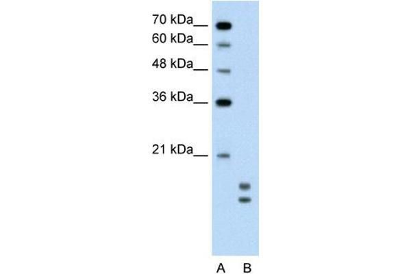 anti-Ubiquitin-Conjugating Enzyme E2L 3 (UBE2L3) (C-Term) antibody