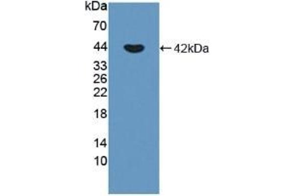 P-Cadherin anticorps  (AA 371-660)