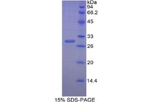 Image no. 1 for Carbonic Anhydrase II (CA2) ELISA Kit (ABIN6574206)