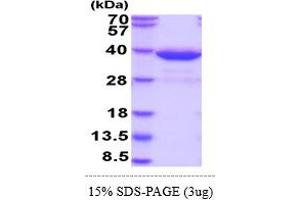 Image no. 1 for Histamine N-Methyltransferase (HNMT) (AA 1-292) (Active) protein (His tag) (ABIN5855072)