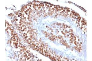Image no. 5 for anti-Wilms Tumor 1 (WT1) antibody (ABIN6940904)