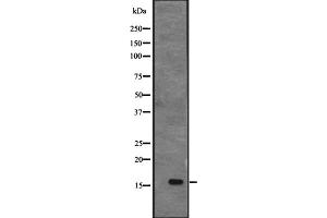 anti-Apoptosis-Inducing, TAF9-Like Domain 1 (APITD1) (C-Term) antibody