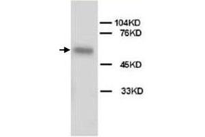 Image no. 2 for anti-Alkaline Phosphatase, Liver/bone/kidney (ALPL) antibody (ABIN540560)