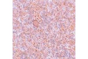 Immunohistochemistry (IHC) image for anti-Retinoblastoma Binding Protein 8 (RBBP8) (Middle Region) antibody (ABIN1031055)