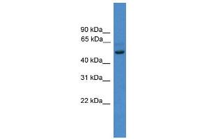 WB Suggested Anti-ZNF277  Antibody Titration: 0.