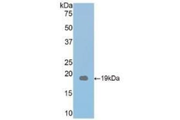 Thrombospondin 1 anticorps  (AA 515-671)
