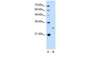 Image no. 2 for anti-Aspartate beta-Hydroxylase (ASPH) (AA 66-115) antibody (ABIN321861)