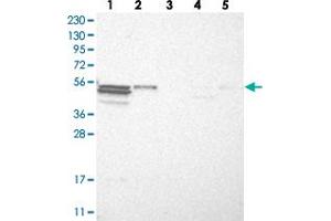 Image no. 2 for anti-Tripartite Motif Containing 11 (TRIM11) antibody (ABIN5590137)