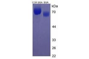 Image no. 2 for Cortisone (COR) protein (BSA) (ABIN1880101)