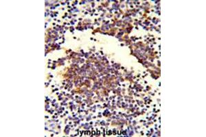 Image no. 2 for anti-Complement Component C7 (C7) (AA 381-411), (Middle Region) antibody (ABIN951642)