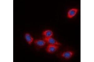 Image no. 2 for anti-DOK2 (DOK2) antibody (ABIN2957550)