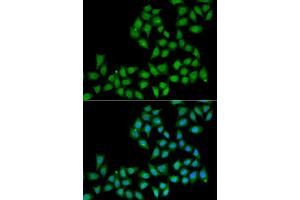 Image no. 2 for anti-E74-Like Factor 1 (Ets Domain Transcription Factor) (ELF1) antibody (ABIN2562397)