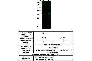 Image no. 1 for anti-FOS-Like Antigen 1 (FOSL1) (Center) antibody (ABIN6925972)