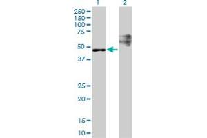 Image no. 1 for anti-StAR-Related Lipid Transfer (START) Domain Containing 3 (STARD3) (AA 1-445) antibody (ABIN564750)