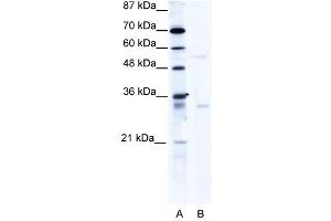 Image no. 1 for anti-TRIM17 / RNF16 (TRIM17) (C-Term) antibody (ABIN925792)