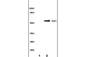 Image no. 2 for anti-Cytochrome P450, Family 11, Subfamily A, Polypeptide 1 (CYP11A1) (AA 321-420) antibody (ABIN701530)