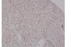 Image no. 2 for anti-Mismatch Repair Protein 2 (MSH2) (N-Term) antibody (ABIN2776761)
