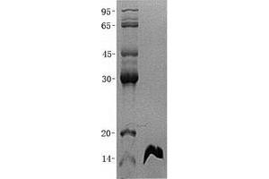 Image no. 1 for Fatty Acid Binding Protein 6, Ileal (FABP6) (Transcript Variant 1) protein (His tag) (ABIN2720671)
